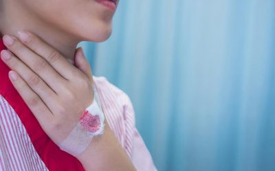 Štitna žlezda – kako nas štiti i šta kada posustane