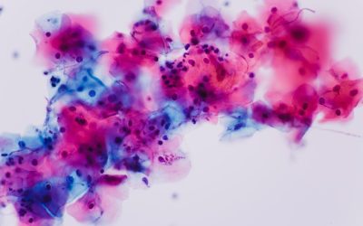 Kandida i Kandidijaza