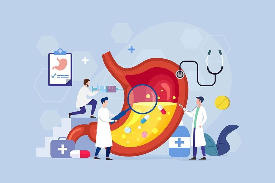 grafička ilustracija koja pokazuje kako lekari ispituju želudac i kiselinu unutar njega uz različite lekove