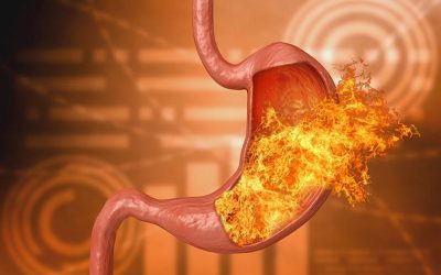 Želudačna kiselina – omražena a korisna