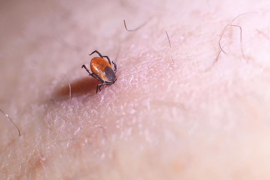 Ugriz krpelja na koži