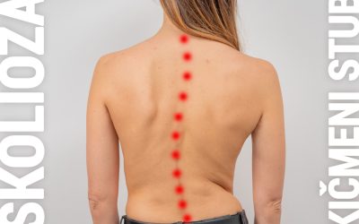 Skolioza