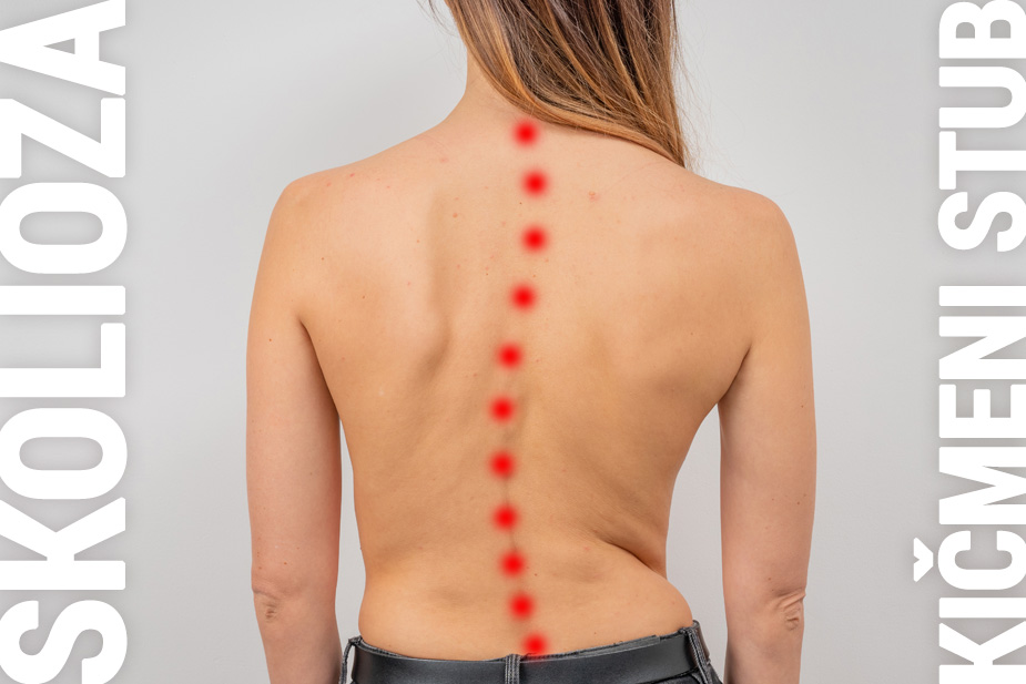 Skolioza